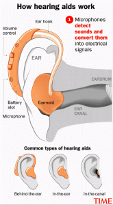 Hearing Aids Are Now Sold Over the Counter: What to Know